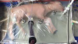 Artificial womb