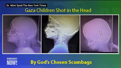 Israel Extermination By Lead Poison to the Head